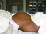 before-surgery