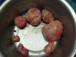 The removed fibroids